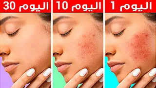حيل مفيدة لحل مشاكل البشرة والعناية بها 