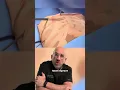 Sunken Chest Surgical Repair