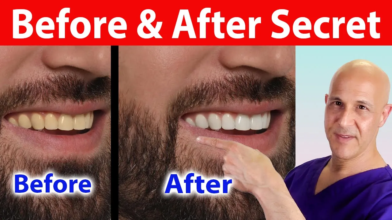 Outline Video This Secret Fruit Whitens Teeth Instantly—You’ll Be Amazed! Dr. Mandell