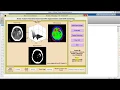 Brain Tumor Detection Using Segmentation and KNN Clustering Matlab Project with Source Code