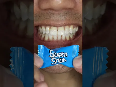 "Super Sour" Nobel Super Soda Candy ASMR
