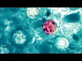 Restaurants changing menus amid cyclosporiasis outbreak