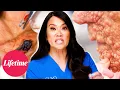 Download Lagu The Most EXTREME Cases (Compilation) | Dr. Pimple Popper: Breaking Out (S1) | Lifetime
