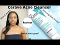 Watch This Before You Buy Cerave Acne Foaming Cream Cleanser Review On Oily Acne prone Skin
