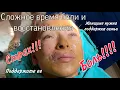Download Lagu Реабелитация🇹🇷пластическая операция в Турции❤️вся правда