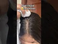 Lagu Cara Saya Mengurangi Area Botak dalam 1 Bulan | Ramuan Ampuh untuk Pertumbuhan Rambut 💆‍♀️ Potli Ajaib untuk Kebotakan