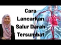Lagu Sakit Jantung : Cara Lancarkan Salur Darah Yang Tersumbat Dengan Berkesan