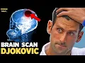 Download Lagu Djokovic Scans after Hit by Bottle in Rome 2024 | Tennis News