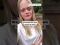 Misconceptions continue to surround Down syndrome but we can change that