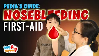 first aid sa pagdugo ng ilong ng bata o nose bleeding doc a pediatrician