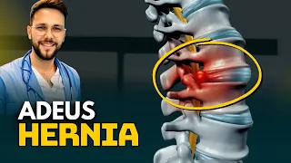 O Melhor Exercicio para DOR Ciatica e HERNIA DE DISCO - McKenzie
