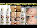 How do I permanently get rid of stretch marks best stretch mark oil meesho