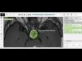 Medical image annotation using CVAT Makesense AI