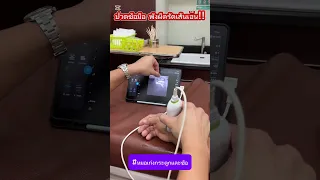  อาการเจ็บที่โคนนิ้วโป้ง และมีอาการบวมหรือปวดเมื่อกดตรงจุดนั้น เป็นเพราะอะไร 