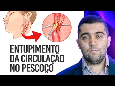 Download MP3 Qual risco da doença nas carótidas, as artérias que levam sangue para a cabeça e o pescoço?