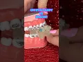 Are crunchy CRYSTAL CANDIES safe for BRACES ASMR eating