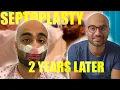 Septoplasty UPDATE 2 years later Was the Pain worth it