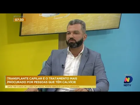 Pesquisa aponta que metade dos homens acima de 50 anos têm calvície