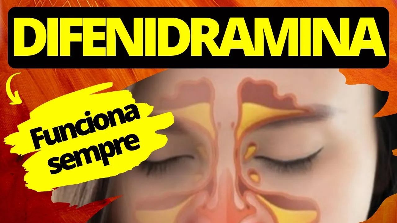 DIFENIDRAMINA: Mecanismo de ação, indicação, contraindicação, interações e cuidados de #enfermagem.