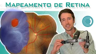 exame de mapeamento de retina