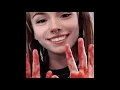Download Lagu Syko - #BrooklynBloodPop! (prod. Duvaal)