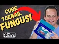 WILL VICK S VAPORUB KILL TOENAIL FUNGUS