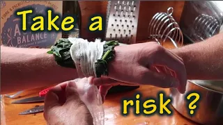 Sailing with a broken wrist – Ep 38