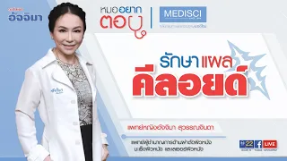  คีลอยด์เกิดจากอะไร และมีอาการอย่างไรบ้าง 