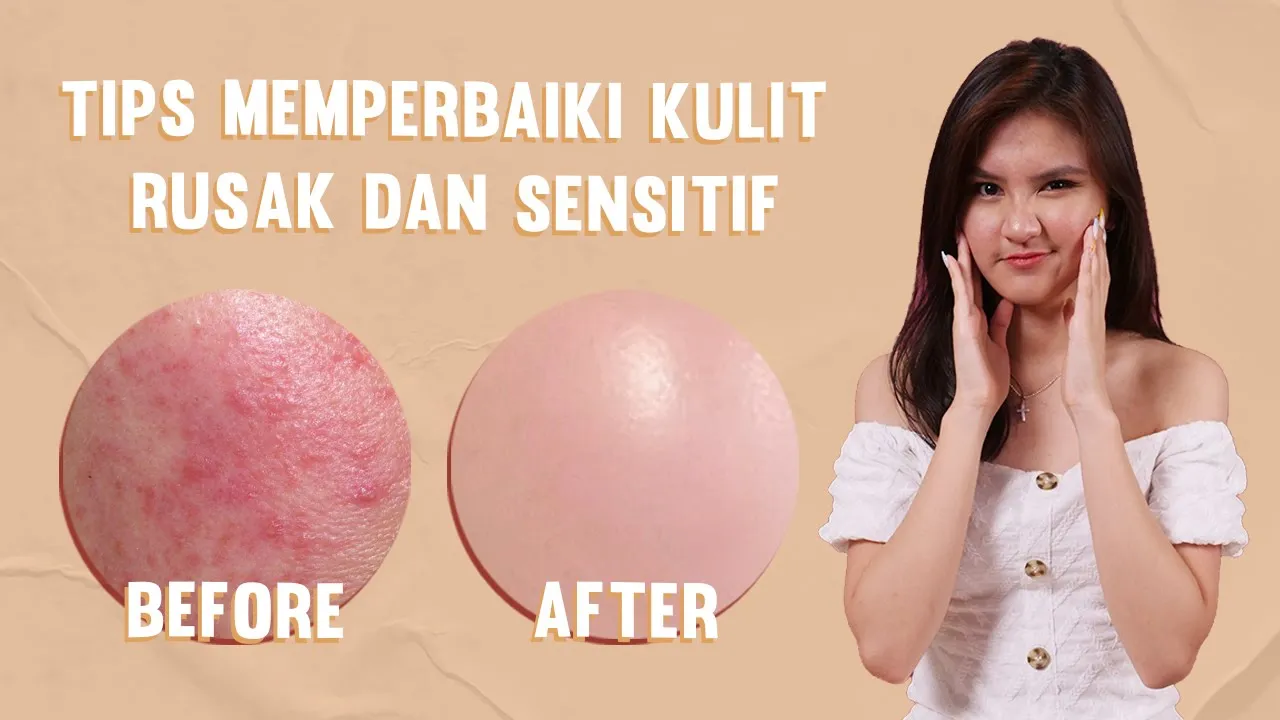 SKINCARE ROUTINE UNTUK KULIT BERJERAWAT - MORNING SKINCARE WAJAH SENSITIF BERUNTUSAN. 