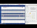 Recording a Perio Pocket Greater than 9 on Dentrix
