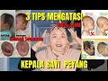 Download Lagu TIPS MENGATASI KEPALA BAYI PEYANG | BIAR KEPALA BAYI TIDAK ASIMETRIS | OPSIMOM BABY PILLOW