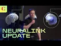 Download Lagu What You Need to Know About Neuralink’s Telepathy Update