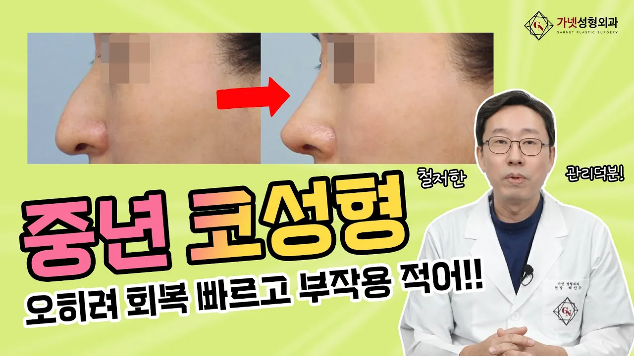 40대 50대 중년 코성형! 중년도 예쁘게 코수술 할수 있어❤️ 오히려 붓기, 멍 적고 회복이 빠르답니다👍