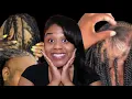 Download Lagu The Truth About Scalp Tonics \u0026 BW BALD FROM BRAIDS‼️Blue Tea \u0026 Why You’re Still Balding‼️