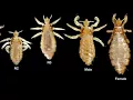 Mayonnaise to remove LICE from the head