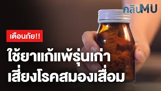 มีความเชื่อมโยงระหว่างการใช้ยาแก้แพ้รุ่นเกอกับโรคสมองเสื่อมหรือไม่