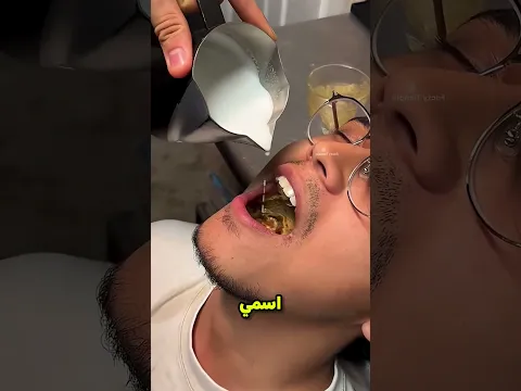 الولد عمل القهوه جوه بقه 😲 #CatLovers #cat #catcartoon#frying