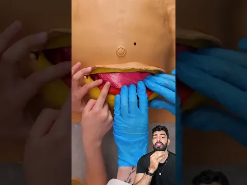 Como é feito o parto cesária