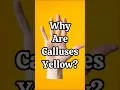 Why Are Calluses Yellow
