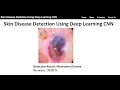 Skin Disease Detection Using Deep Learning CNN Python Project Skin Disease Classification Python