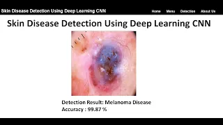 Skin Disease Detection Using Deep Learning CNN Python Project Skin Disease Classification Python