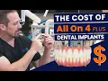True Cost of All On 4 Plus Dental Implants