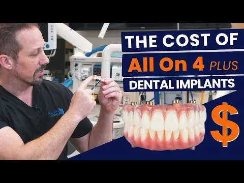 Download MP3 True Cost of All On 4 Plus® Dental Implants