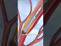 Download Lagu Así se hace una ANGIOPLASTIA en el CORAZÓN 🫀👀❤️‍🩹