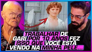 A MULHER que DESAFIOU o impossível: 73 cânceres, abandono e pobreza - HILÁRIA MIRESKI