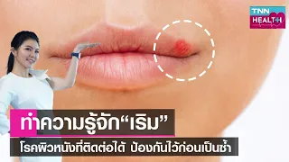 โรคเริมเกิดจากเชื้ออะไร และมีลักษณะอาการอย่างไรบ้าง