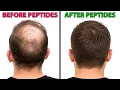 The MIRACLE Peptides To Regrow Your Hair Hair Surgeon Reacts