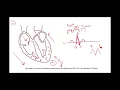 Module 1-EKG Basics EKG Fundamentals Series