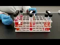 Microbiology of Water Presumptive Test
