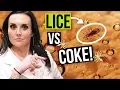 Removing Head Lice with Coca Cola Coke - Watch this BEFORE you try